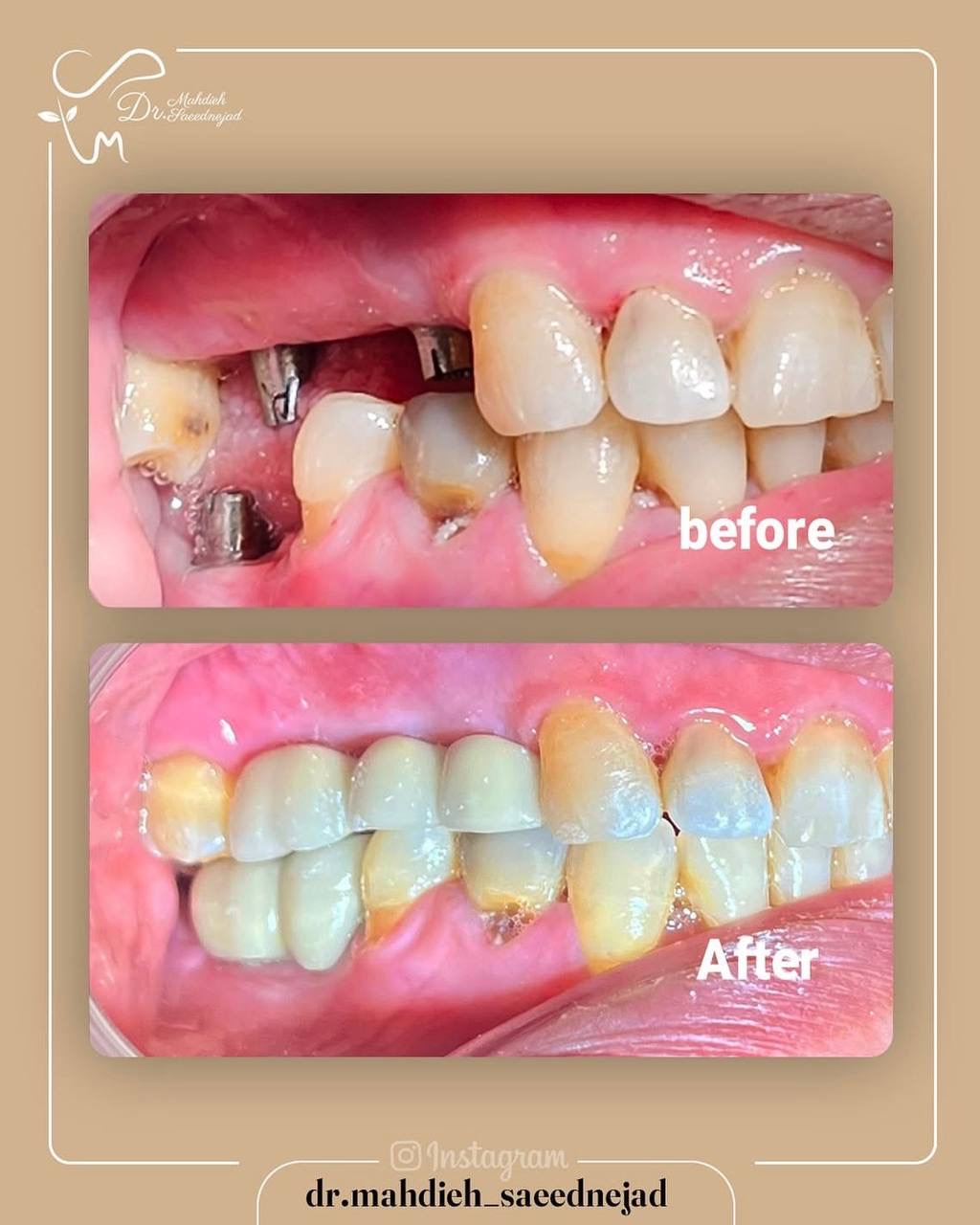 مهدیه سعیدنژاد