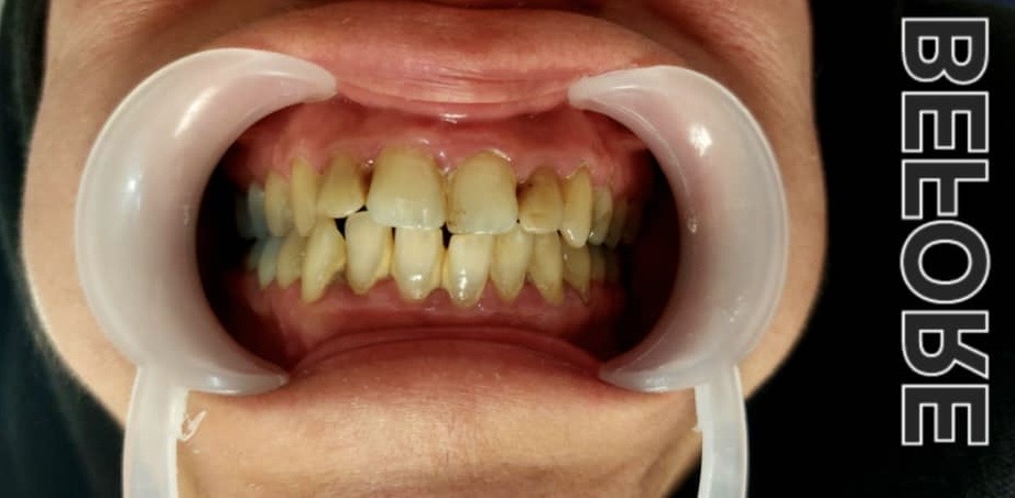 نازی برهنه پوشان