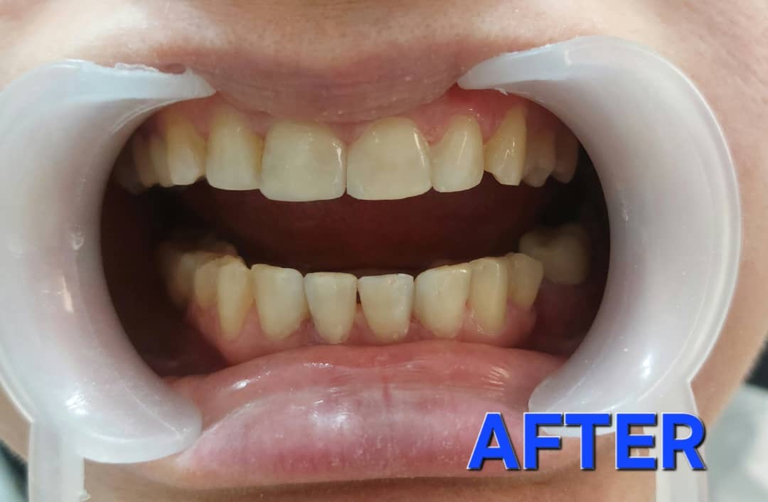 نازی برهنه پوشان