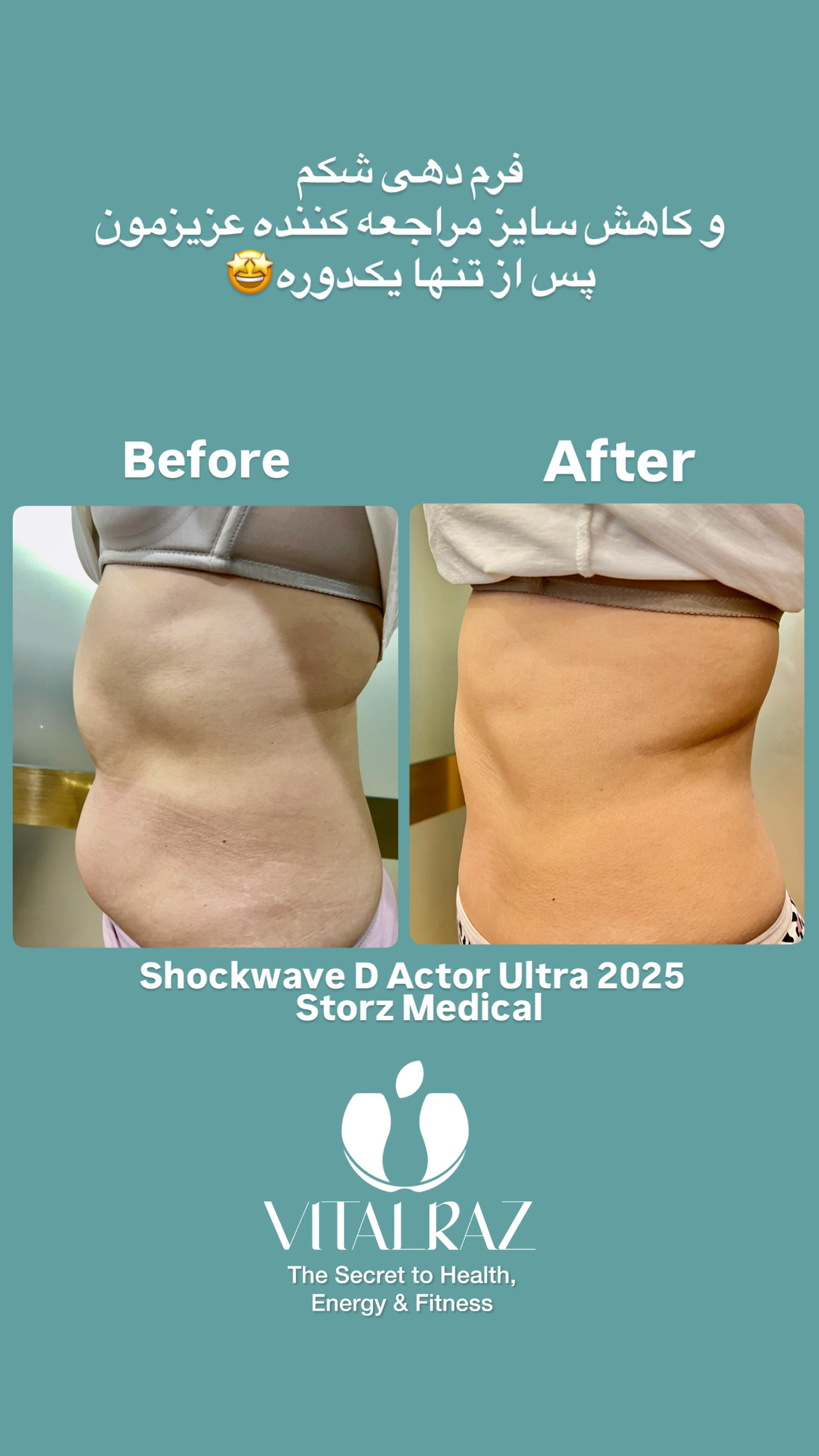 راضیه حسینی